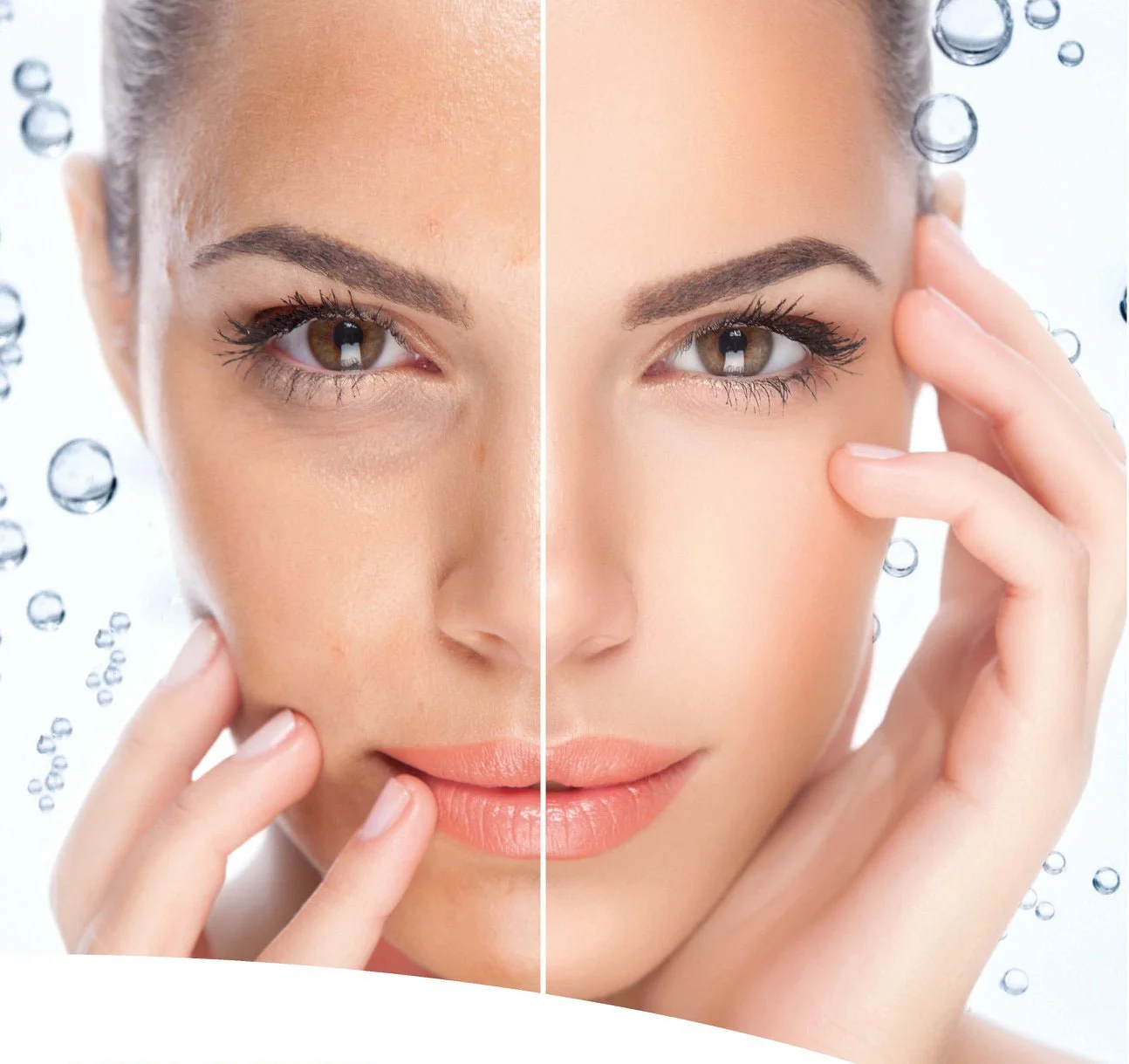 Lift & Peel (80 min.)